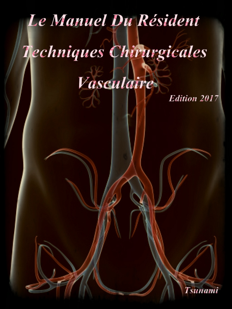 Le Manuel Du Résident 2017 : Techniques Chirurgicales Vasculaire P_455cskiq3